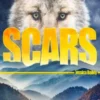 Scars