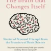 The Brain That Changes Itself